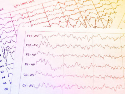 EEG electrophysiological SH 717274453